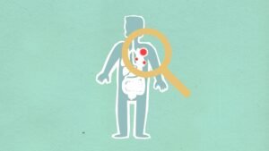 Paper cutout of man under magnifying glass with red viruses spreading on internal organs on green background during disease propagation